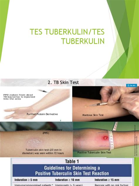 Tes Tuberkulin Pdf