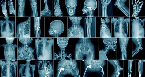 When Is World Radiography Day What Is Its Significance