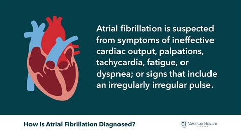 Atrial Fibrillation Youtube