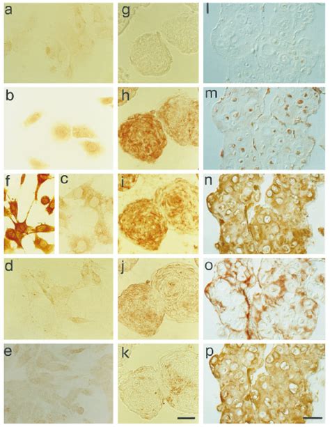 Immunoperoxidase Localization Of Runt Product During In Vitro