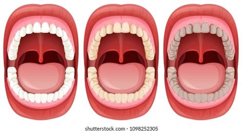 Set Human Mouth Anatomy Illustration Stock Vector (Royalty Free ...