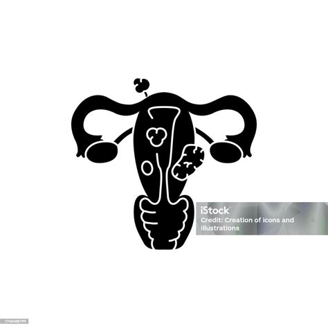 Uterine Myoma Color Line Icon Gynecology Problem Stock Illustration