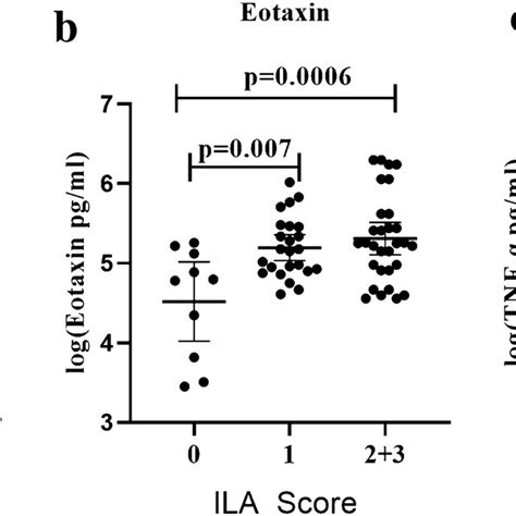 Relationship Between Serum Levels Of Cytokines And The Severity Of Ild Download Scientific