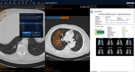 Advance Chest Ct Sectra Global E Learning