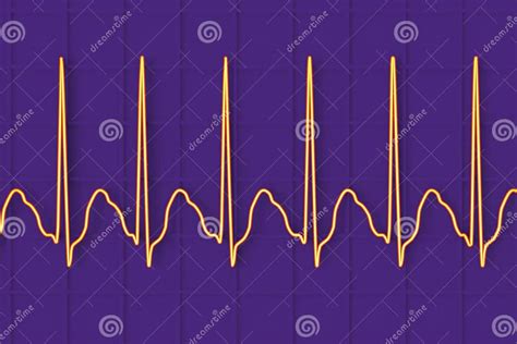 Ecg In Atrial Flutter 3d Illustration Stock Illustration