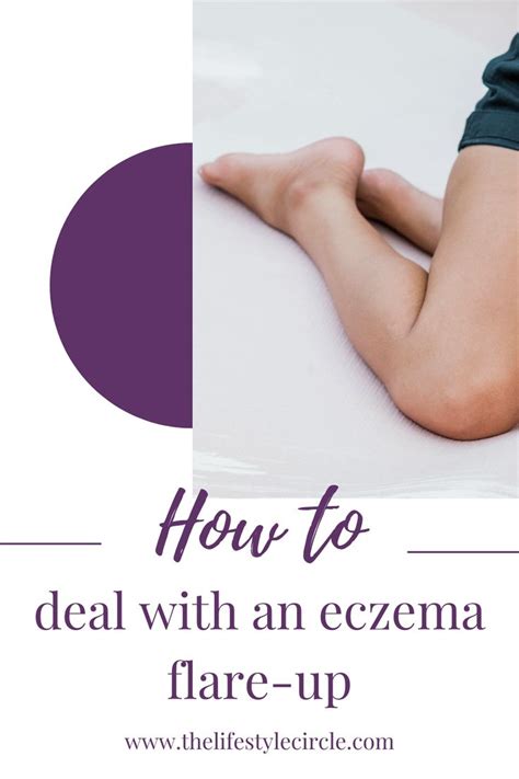 How To Deal With An Eczema Flare Up In 2021 Eczema Flares Healthy Skin