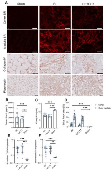 Ijms Free Full Text The Vegf Inhibitor Soluble Fms Like Tyrosine