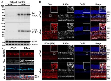 Frontiers Human Tau Expression Does Not Induce Mouse Retina