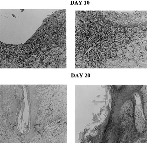 Photomicrographs of the wound area and its surrounding tissue covered ...