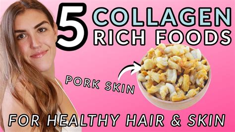 Collagen Rich Foods For Skin And Hair Top 5 Youtube