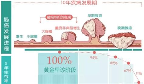 惠民结直肠癌无创筛查黑科技粪便sdc2甲基化检测 人群 肿瘤 肠道