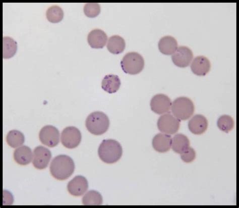 Feline mycoplasmosis - Symptoms and treatment