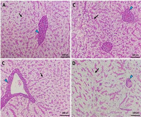 Histomicrograph Showing The Histological Structure Of Hepatopancreas In