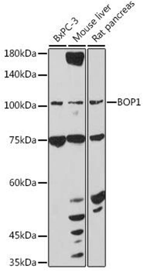 Anti Bop1 抗体 Assay Genie