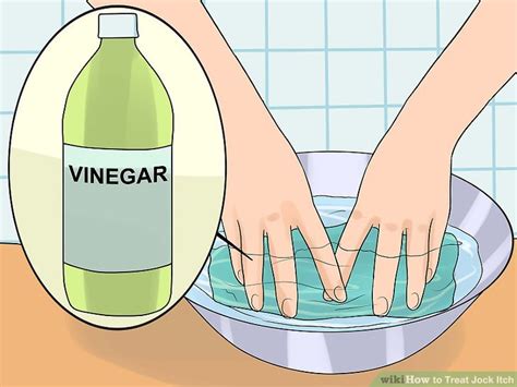 How to Treat Jock Itch: 14 Steps (with Pictures) - wikiHow