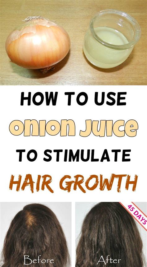 How To Use Onions To Stimulate Hair Growth Beautytotal Org Onion