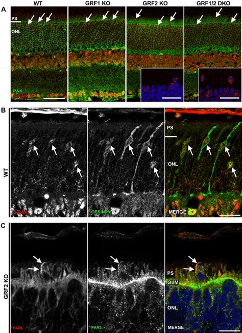 Molecular Identity Of Cells Harboring Displaced Ectopic Nuclei A