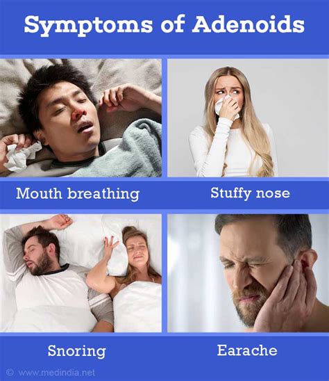 Adenoids | Adenoiditis - Causes, Symptoms, Complications, Diagnosis ...