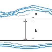 Schematic diagram of the scar tissue formation index. The scar tissue ...