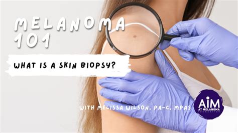 What Is A Skin Biopsy Youtube