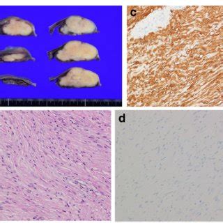 Representative Photomicrographs Of Tissue Sections A Massive White