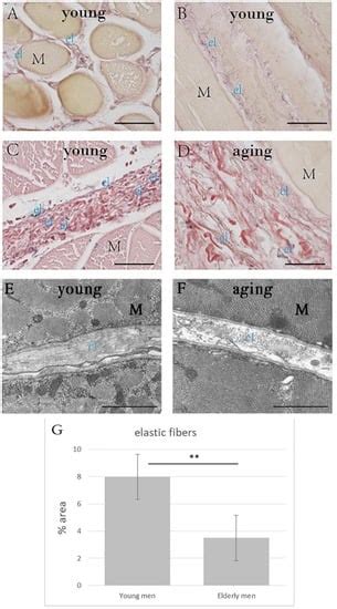 IJMS Free Full Text The Effects Of Aging On The Intramuscular