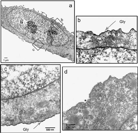 Transmission Electron Microscopy Photograph Presenting Bovine