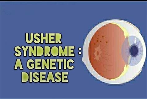 Usher Syndromea Genetic Disease Platform Cme