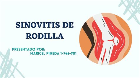 Sinovitis De Rodilla MARICEL PINEDA UDocz