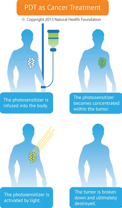 Photodynamische Therapie