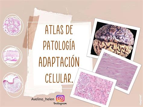 Atlas de Patología Adaptación Celular Helen Avelino uDocz