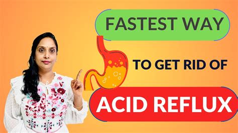 Get Rid Of Acid Reflux Naturally Acidreflux Gerd Heartburnrelief