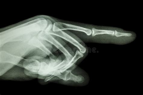 Human is Pointing the Finger Stock Photo - Image of bone, exam: 38652160