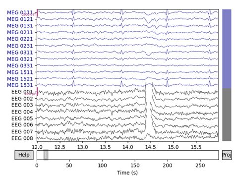 Overview Of Meg Eeg Analysis With Mne Python Mne Documentation