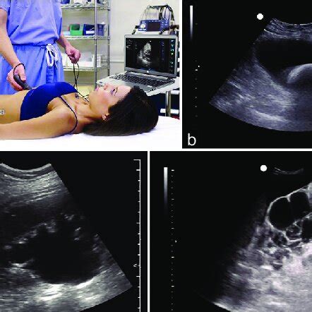 A Sonosim Livescan Simulates Real Pathologies On Manikins And Live