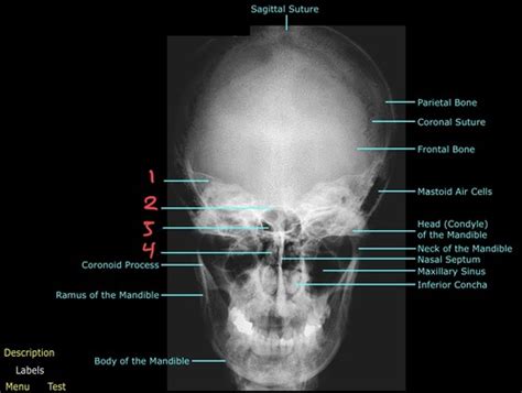 Radiographs Flashcards Quizlet