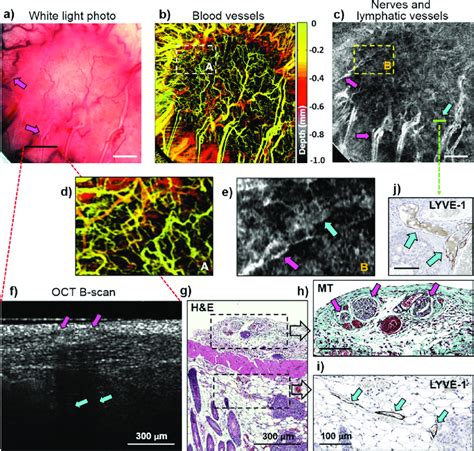 Angiography Lymphangiography Neurography And Histology Of Pancreatic