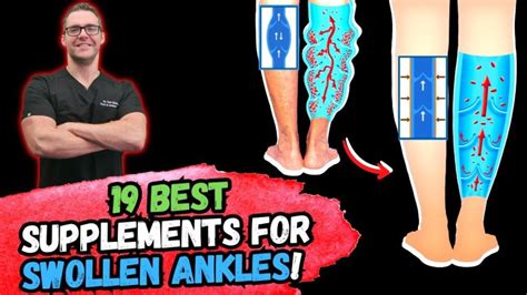 BEST 19 Supplements to FIX SWOLLEN Feet & Ankles!