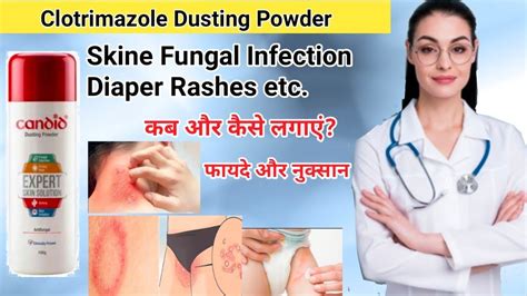 Clotrimazole Dusting Powder Candid Powder For Baby Rashes Candid