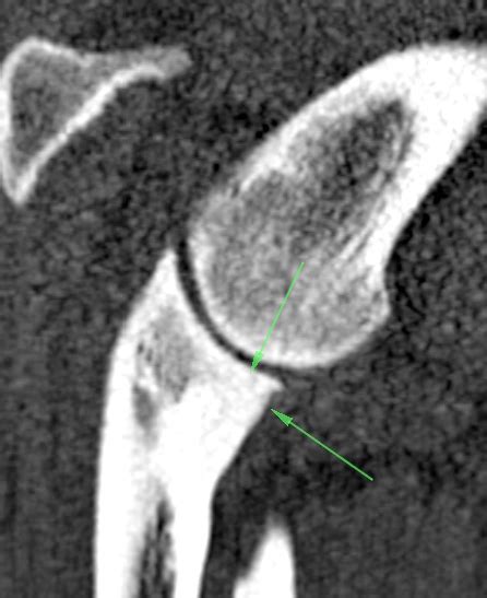 What Does A Dog Ct Scan Show