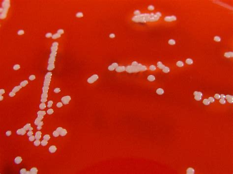 Staphylococcus haemolyticus on Columbia Horse Blood Agar - Detail - a ...