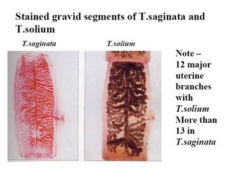 Taenia Mature Proglottid Label