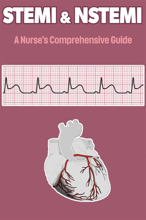 Stemi Nstemi A Nurse S Comprehensive Guide Health And Willness Sexiz Pix