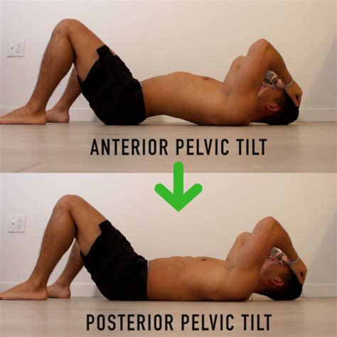 Fix Anterior Pelvic Tilt In Minutes Per Day With This Corrective