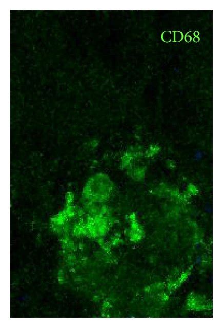 A C Misfolded SOD1 MisSOD1 Immunolabeling Using AJ10 Antibody