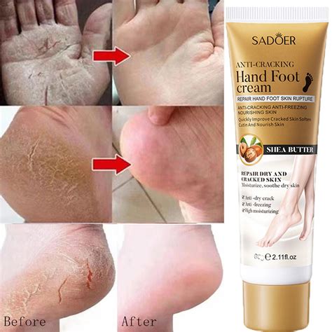 Sadoer Herbal Anti Crack Foot Cream Anti Drying Crack Heel Cracked Repair Removal Dead Relieve