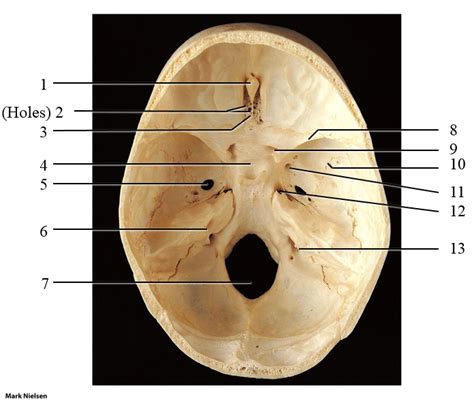 Skull Superior Foramen Diagram Quizlet