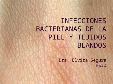 Ppt Infecciones Bacterianas De La Piel Y Tejidos Blandos Dra Elvira