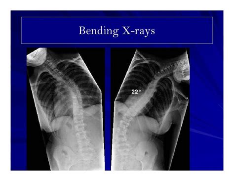 Case Presentation 8 14 Year Old Female Presented With Adolescent Id