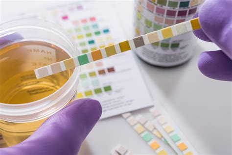 Urine Toxicology: Understanding the Power of Diagnostic Testing ...